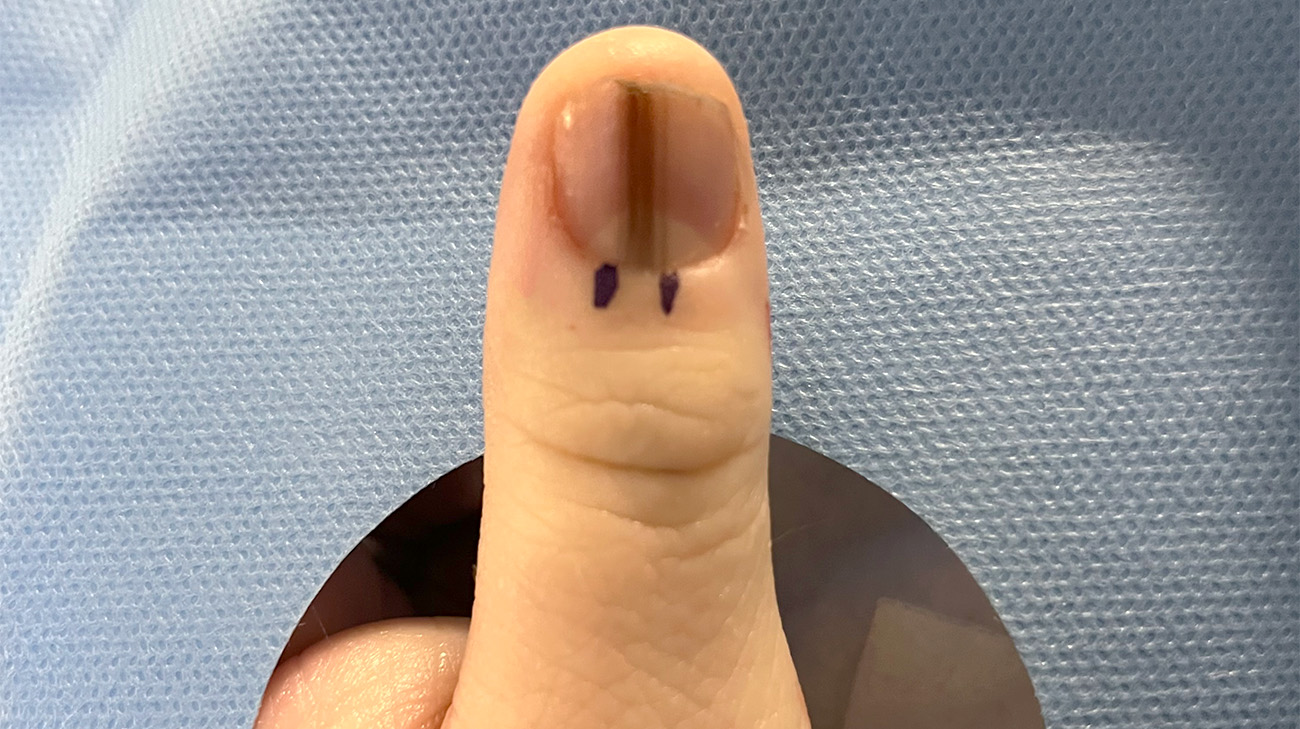 Lauren's nail