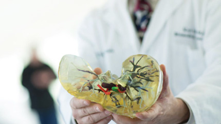 Transplant Patient Education | Cleveland Clinic